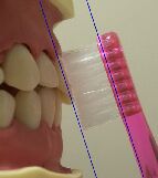 歯ブラシと上顎前歯の関係
